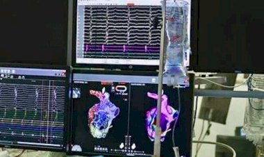 Ürəyin “kiçik beyni”nin 3D xəritəsi hazırlandı