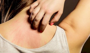 Britaniyada epidemiya yayılıb